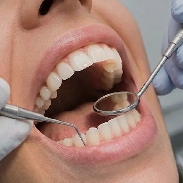Revisión dental con espejo y explorador