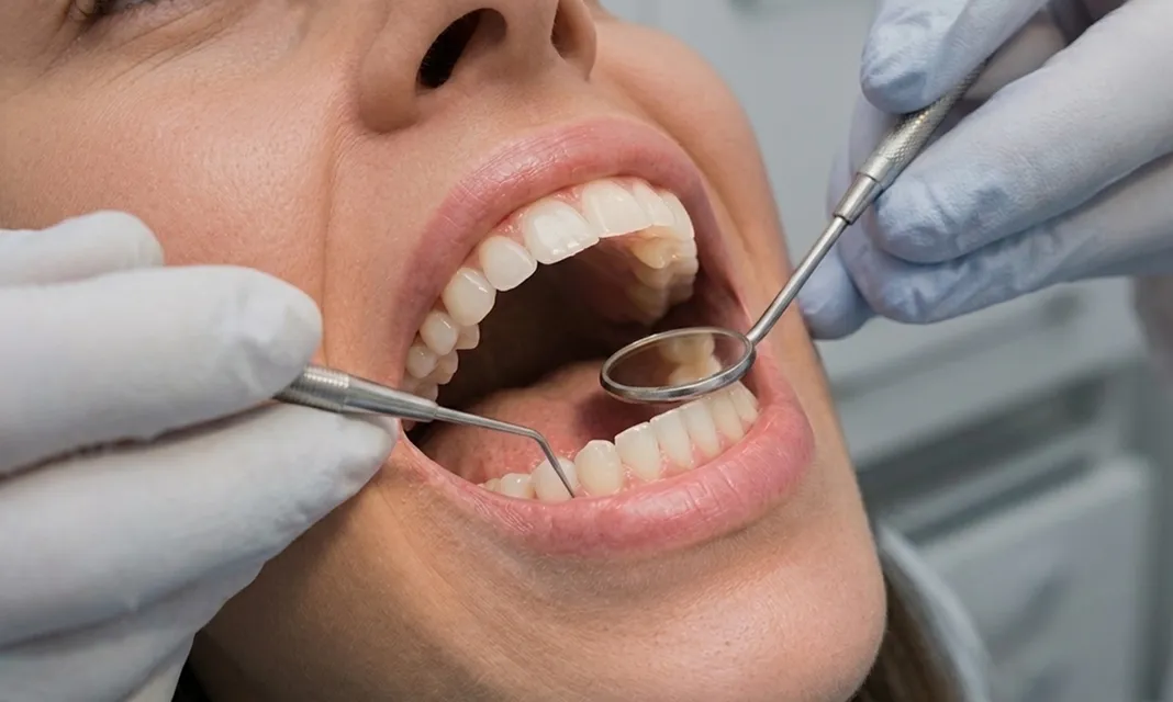 Revisión dental de control con espejo y explorador